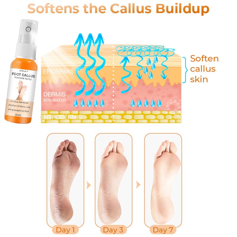 GFOUK™ Foot Callus Removal Spray